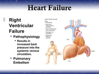Heart Failure
 Right
  Ventricular
  Failure
   Pathophysiology
     Results in
      increased back
      pressure into the
      systemic venous
      circulation.
   Pulmonary
    Embolism
 