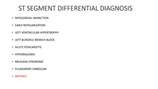 ST SEGMENT DIFFERENTIAL DIAGNOSIS
• MYOCARDIAL INFARCTION
• EARLY REPOLARIZATION
• LEFT VENTRICULAR HYPERTROPHY
• LEFT BUNDDLE BRANCH BLOCK
• ACUTE PERICARDITIS
• HYPERKALEMIA
• BRUGADA SYNDROME
• PULMONARY EMBOLISM
• ARTIFACT
 