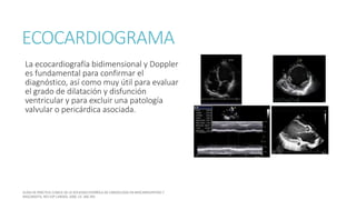 ECOCARDIOGRAMA
La ecocardiografía bidimensional y Doppler
es fundamental para confirmar el
diagnóstico, así como muy útil para evaluar
el grado de dilatación y disfunción
ventricular y para excluir una patología
valvular o pericárdica asociada.
 