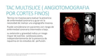 TAC MULTISLICE ( ANGIOTOMOGRAFIA
POR CORTES FINOS)
Técnica no invasiva para evaluar la presencia
de enfermedad coronaria y guiar en la
necesidad de realizar una angiografía invasiva.
Puede considerarse en pacientes con riesgo de
enfermedad coronaria intermedio o bajo.
su extensión y gravedad indica un riesgo
mayor de eventos cardiovasculares,
independientemente de la presencia de
isquemia en los estudios de perfusión.
 