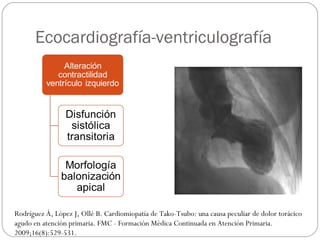 Ecocardiografía-ventriculografía
Rodríguez À, López J, Ollé B. Cardiomiopatía de Tako-Tsubo: una causa peculiar de dolor torácico
agudo en atención primaria. FMC - Formación Médica Continuada en Atención Primaria.
2009;16(8):529-531.
 