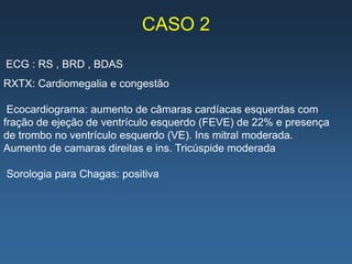 CASO 2

ECG : RS , BRD , BDAS
RXTX: Cardiomegalia e congestão

 Ecocardiograma: aumento de câmaras cardíacas esquerdas com
fração de ejeção de ventrículo esquerdo (FEVE) de 22% e presença
de trombo no ventrículo esquerdo (VE). Ins mitral moderada.
Aumento de camaras direitas e ins. Tricúspide moderada

Sorologia para Chagas: positiva
 