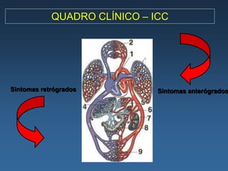QUADRO CLÍNICO – ICC




Sintomas retrógrados          Sintomas anterógrados
 