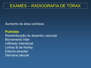 EXAMES – RADIOGRAFIA DE TÓRAX



Aumento da área cardíaca

Pulmões
Redistribuição do desenho vascular
Borramento hilar
infiltrado intersticial
Linhas B de Kerley
Edema alveolar
Derrame pleural
 
