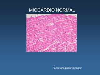MIOCÁRDIO NORMAL




        Fonte: anatpat.unicamp.br
 