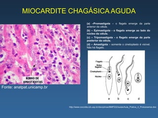 MIOCARDITE CHAGÁSICA AGUDA
                                             (a) –Promastigota – o flagelo emerge da parte
                                             anterior da célula.
                                             (b) – Epimastigota - o flagelo emerge ao lado do
                                             núcleo da célula.
                                             (c) – Tripomastigota - o flagelo emerge da parte
                                             posterior da célula.
                                             (d) – Amastigota – somente o cinetoplasto é visível.
                                             Não há flagelo.




Fonte: anatpat.unicamp.br



                            http://www.coccidia.icb.usp.br/disciplinas/BMP222/aulas/Aula_Pratica_4_Protozoarios.doc
 