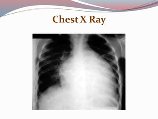 Chest X Ray
 
