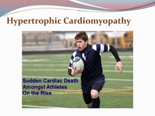 Hypertrophic Cardiomyopathy
 