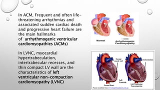 animal models for evaluation of drugs for Cardiomyopathies | PPTX