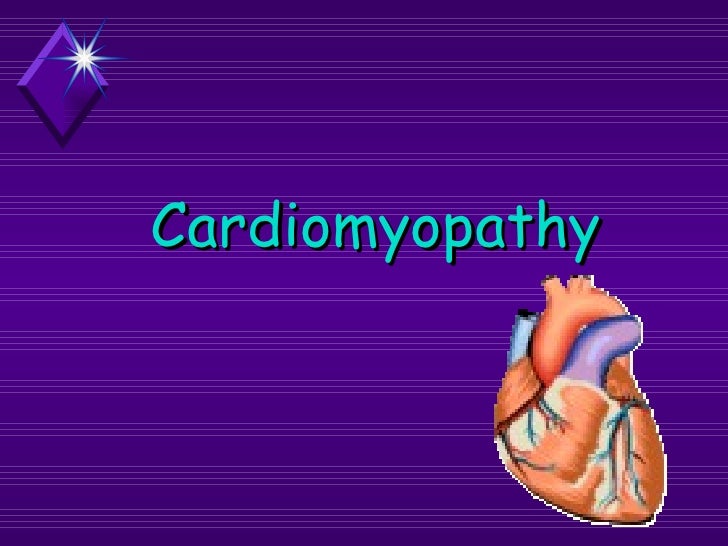Cardiomyopathy
