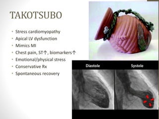 TAKOTSUBO
• Stress cardiomyopathy
• Apical LV dysfunction
• Mimics MI
• Chest pain, ST↑, biomarkers↑
• Emotional/physical stress
• Conservative Rx
• Spontaneous recovery
 