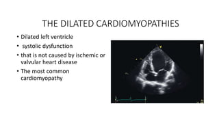 THE DILATED CARDIOMYOPATHIES
• Dilated left ventricle
• systolic dysfunction
• that is not caused by ischemic or
valvular heart disease
• The most common
cardiomyopathy
 