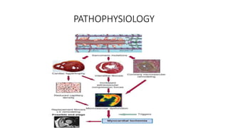 PATHOPHYSIOLOGY
 