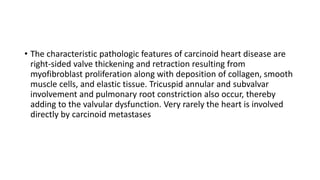 • The characteristic pathologic features of carcinoid heart disease are
right-sided valve thickening and retraction resulting from
myofibroblast proliferation along with deposition of collagen, smooth
muscle cells, and elastic tissue. Tricuspid annular and subvalvar
involvement and pulmonary root constriction also occur, thereby
adding to the valvular dysfunction. Very rarely the heart is involved
directly by carcinoid metastases
 