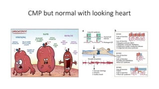CMP but normal with looking heart
 