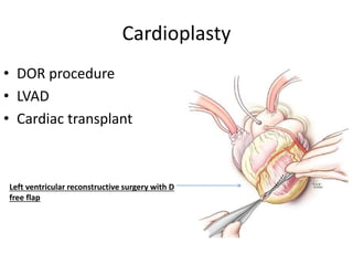Cardioplasty
• DOR procedure
• LVAD
• Cardiac transplant
Left ventricular reconstructive surgery with D
free flap
 