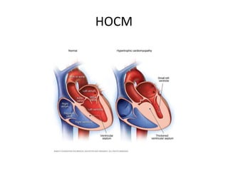 HOCM
 