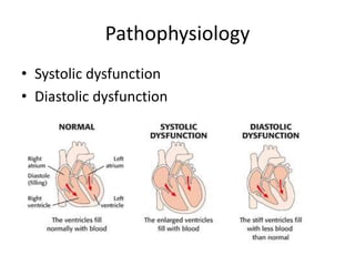 Pathophysiology
• Systolic dysfunction
• Diastolic dysfunction
 