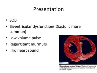 Presentation
• SOB
• Biventricular dysfunction( Diastolic more
common)
• Low volume pulse
• Regurgitant murmurs
• IIIrd heart sound
 