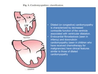 • Dilated (or congestive) cardiomyopathy
is characterized by decreased
contractile function of the ventricle
associated with ventricular dilatation.
• Endocardial fibroelastosis (seen in
infancy) and doxorubicin
cardiomyopathy (seen in children who
have received chemotherapy for
malignancies) have clinical features
similar to those of dilated
cardiomyopathy
 