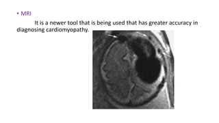 • MRI
It is a newer tool that is being used that has greater accuracy in
diagnosing cardiomyopathy.
 