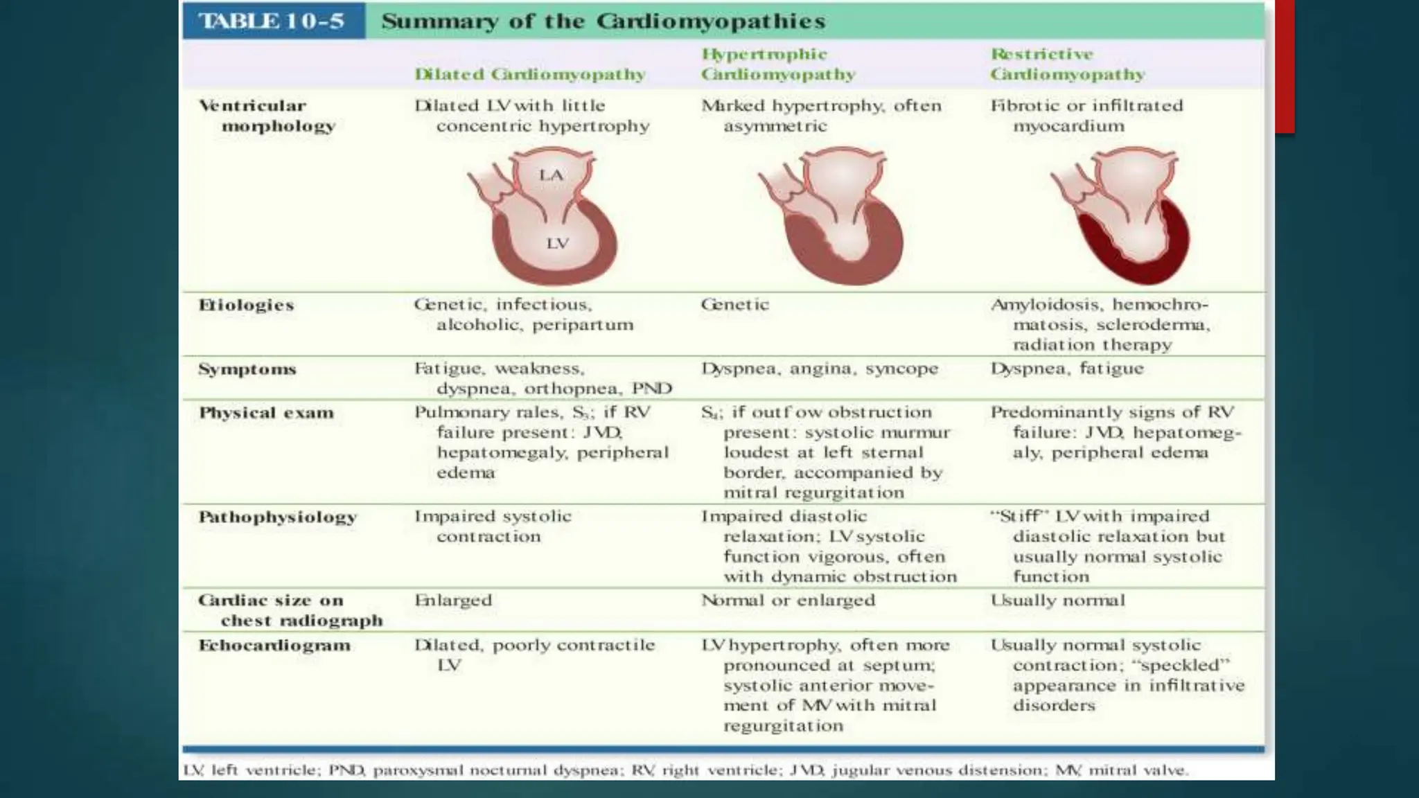 Cardiomyopathy - Internal Medicine .pptx