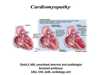 Chala.F, MD, consultant internist and cardiologist
Assistant professor
AAU, CHS, SoM, cardiology unit
Cardiomyopathy
Cardiomyopathy
 