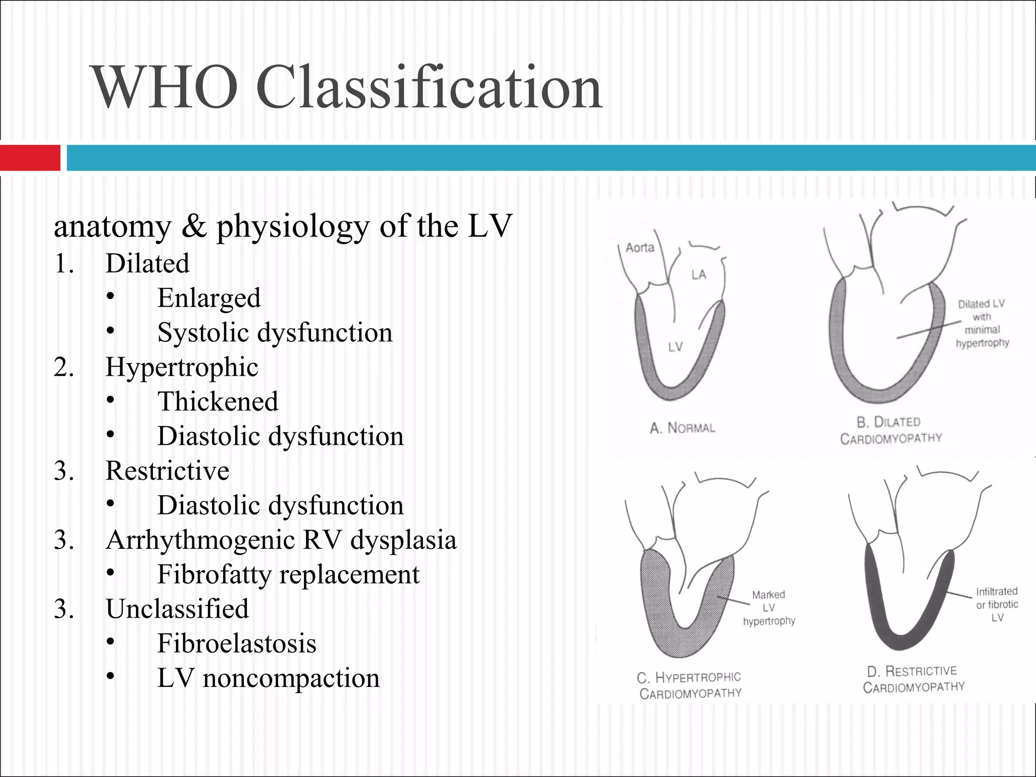 WHO Classification
anatomy & physiology of the LV
1. Dilated
• Enlarged
• Systolic dysfunction
2. Hypertrophic
• Thickened
• Diastolic dysfunction
3. Restrictive
• Diastolic dysfunction
3. Arrhythmogenic RV dysplasia
• Fibrofatty replacement
3. Unclassified
• Fibroelastosis
• LV noncompaction
 