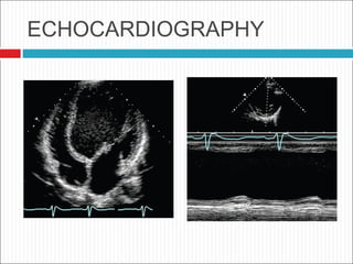 ECHOCARDIOGRAPHY
 