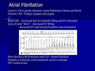 Wave Blockers cardiomyopathy.ppt