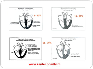 8 - 10% 15 - 20%
65 - 70%
www.kanter.com/hcm
 