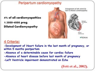 Peripartum cardiomyopathy
(Fett et al., 2002).
4% of all cardiomyopathies
1:3000-4000 preg.
Dilated Cardiomyopathy
:Criteria4
-Development of Heart failure in the last month of pregnancy, or
within 5 months postpartum
-Absence of a determinable cause for cardiac failure
-Absence of heart disease before last month of pregnancy
-Left Ventricle impairment demonstrated on Echo
 