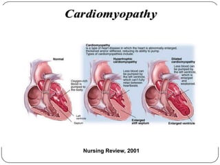 CardiomyopathyCardiomyopathy
Nursing Review, 2001
 