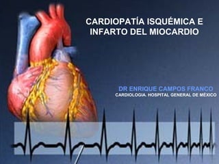 CARDIOPATÍA ISQUÉMICA E
INFARTO DEL MIOCARDIO

DR ENRIQUE CAMPOS FRANCO
CARDIOLOGIA. HOSPITAL GENERAL DE MÉXICO

 