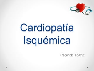 Cardiopatía 
Isquémica 
Frederick Hidalgo 
 
