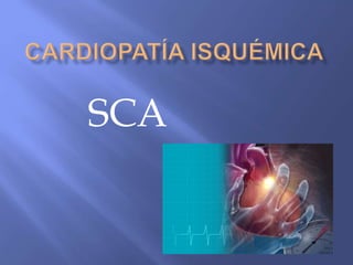 (2015-01-22) Cardiopatía isquémica (PPT)