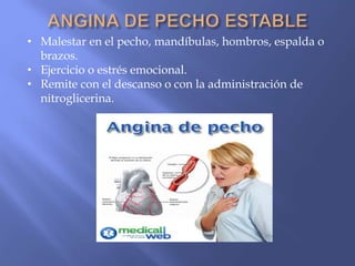 (2015-01-22) Cardiopatía isquémica (PPT)