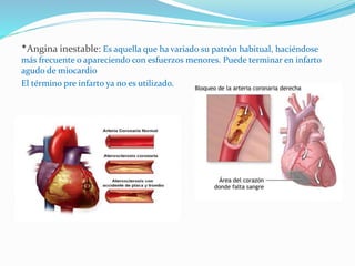 *Angina inestable: Es aquella que ha variado su patrón habitual, haciéndose
más frecuente o apareciendo con esfuerzos menores. Puede terminar en infarto
agudo de miocardio
El término pre infarto ya no es utilizado.
 