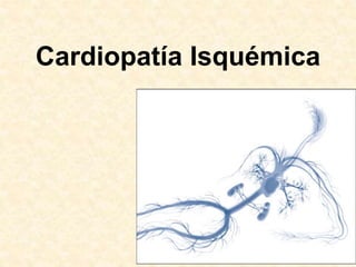 Cardiopatía Isquémica
 