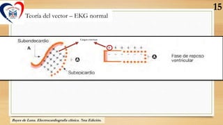 Teoría del vector – EKG normal
Cargas externas
Bayes de Luna. Electrocardiografía clínica. 7ma Edición.
15
 