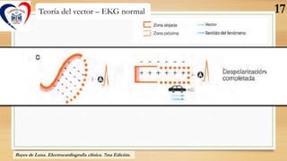 Teoría del vector – EKG normal
Cargas externas
Bayes de Luna. Electrocardiografía clínica. 7ma Edición.
17
 