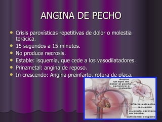 ANGINA DE PECHO Crisis paroxísticas repetitivas de dolor o molestia torácica. 15 segundos a 15 minutos. No produce necrosis. Estable: isquemia, que cede a los vasodilatadores. Prinzmetal: angina de reposo. In crescendo: Angina preinfarto, rotura de placa. 