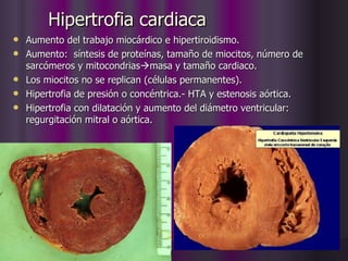 Hipertrofia cardiaca Aumento del trabajo miocárdico e hipertiroidismo. Aumento:  síntesis de proteínas, tamaño de miocitos, número de sarcómeros y mitocondrias  masa y tamaño cardiaco. Los miocitos no se replican (células permanentes). Hipertrofia de presión o concéntrica.- HTA y estenosis aórtica. Hipertrofia con dilatación y aumento del diámetro ventricular: regurgitación mitral o aórtica. 