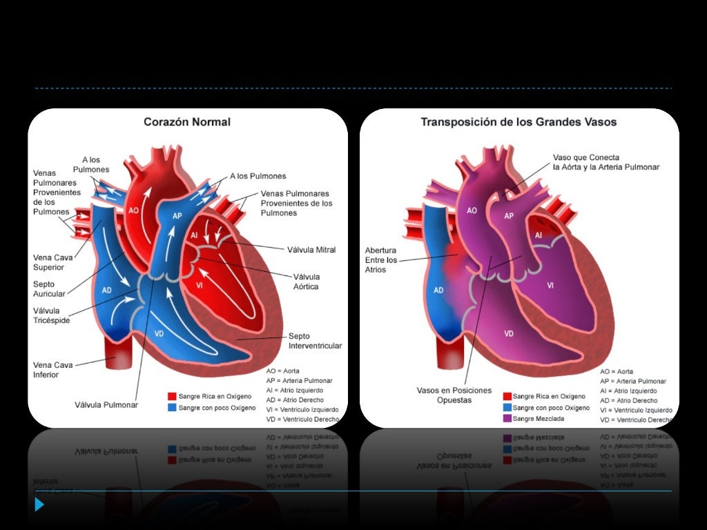 Cardiopatia Congenita Cianogena Mas Frecuente