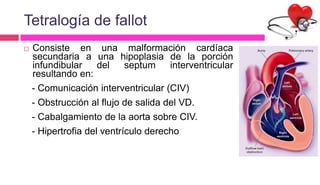 Tetralogía de fallot
 Consiste en una malformación cardíaca
secundaria a una hipoplasia de la porción
infundibular del septum interventricular
resultando en:
- Comunicación interventricular (CIV)
- Obstrucción al flujo de salida del VD.
- Cabalgamiento de la aorta sobre CIV.
- Hipertrofia del ventrículo derecho
 