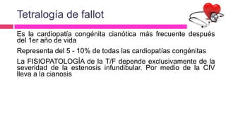 Tetralogía de fallot
Es la cardiopatía congénita cianótica más frecuente después
del 1er año de vida
Representa del 5 - 10% de todas las cardiopatías congénitas
La FISIOPATOLOGÍA de la T/F depende exclusivamente de la
severidad de la estenosis infundibular. Por medio de la CIV
lleva a la cianosis
 