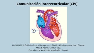 Comprehensive Overview of Congenital Heart Diseases in Newborns ...