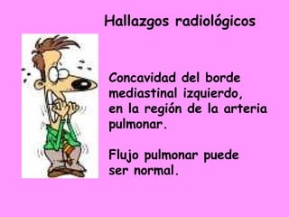 Hallazgos radiológicos


Concavidad del borde
mediastinal izquierdo,
en la región de la arteria
pulmonar.

Flujo pulmonar puede
ser normal.
 