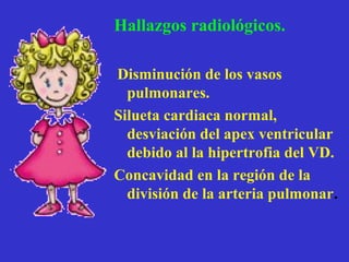 Hallazgos radiológicos.

Disminución de los vasos
  pulmonares.
Silueta cardiaca normal,
  desviación del apex ventricular
  debido al la hipertrofia del VD.
Concavidad en la región de la
  división de la arteria pulmonar.
 