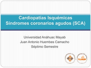 Universidad Anáhuac Mayab
Juan Antonio Huembes Camacho
Séptimo Semestre
Cardiopatías Isquémicas
Síndromes coronarios agudos (SCA)
 